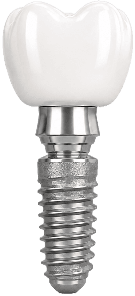 Titanium dental implant with a ceramic crown